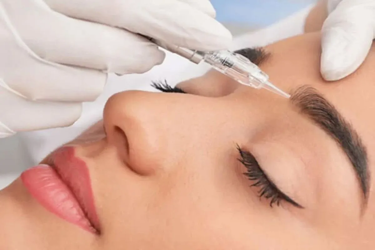 مرکز تخصصی پیوند کاشت ابرو کاشت ابرو به روش DHI در تهران