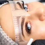 کاشت ابرو به روش FUT