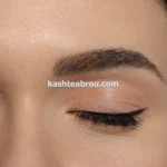 کاشت ابرو دائمی و جراحی پلک طبیعی افتاده در تهران